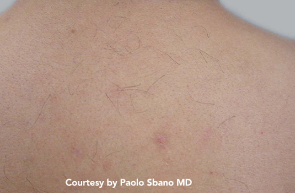 Quanta_Duetto_MT_After Quanta_Duetto_MT_After