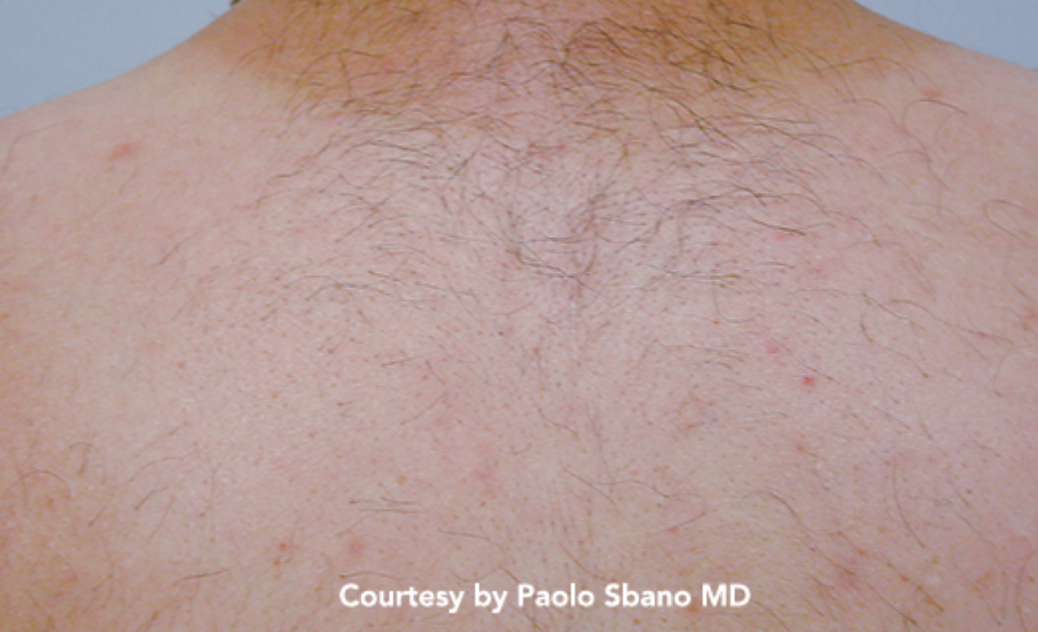 Quanta_Duetto_MT_Before Quanta_Duetto_MT_Before